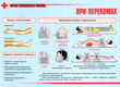 ПВ05 Первая помощь при чрезвычайных ситуациях (самокл.пленка, А3, 9 листов) - Плакаты - Медицинская помощь - Магазин охраны труда Протекторшоп